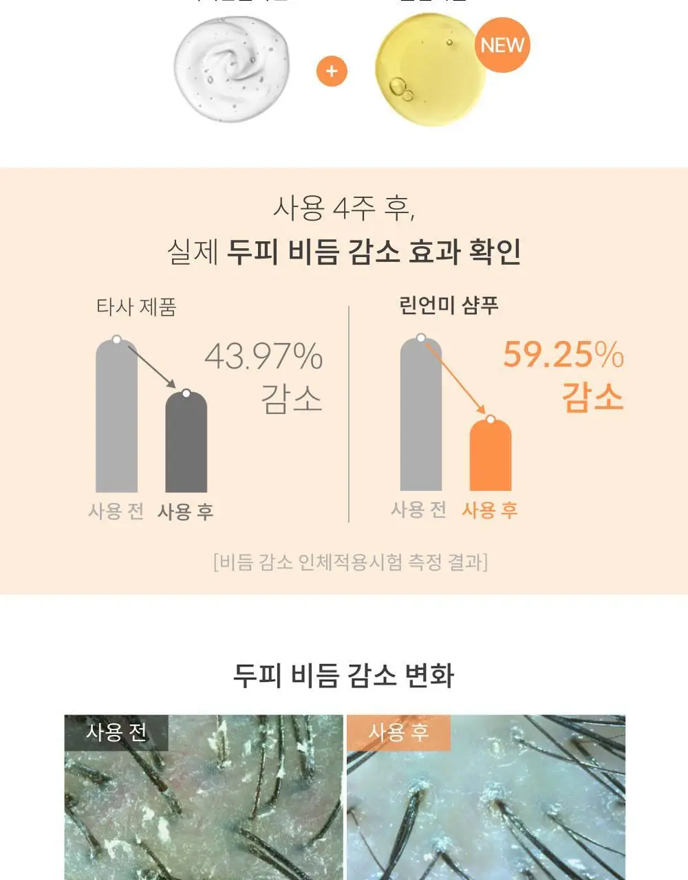 [맞춤형 탈모샴푸] 위드비컨 두피 코렉팅 샴푸 360ml(두피별 샴푸) 상세페이지 51